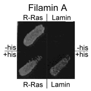 Yeast two hybrid screen of R-Ras binding to FLNa.jpg
